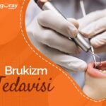 Bruksizm Tedavisi için Fizyoterapistin Rolü