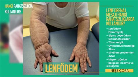 Manuel Lenf Drenaj Masajı Nasıl Yapılır?