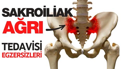 Sakroiliak Eklem Disfonksiyonu Belirtileri ve Tedavisi